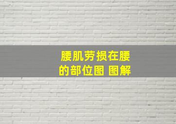 腰肌劳损在腰的部位图 图解